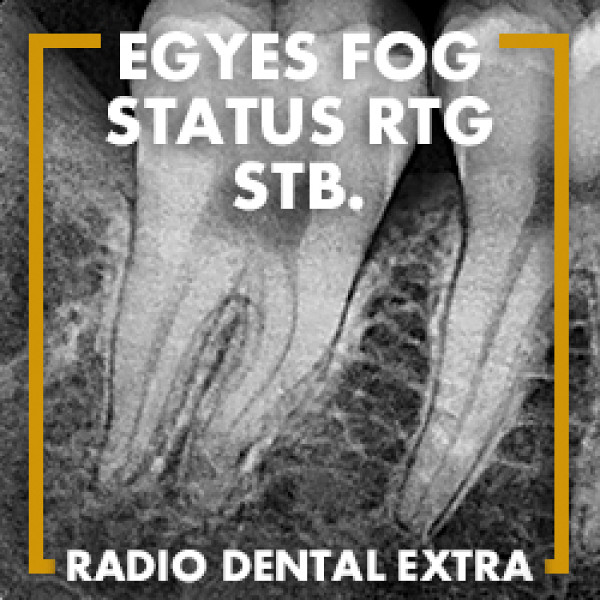 Röntgen - 2. helyiség - Fogászati és fül-orr-gégészeti röntgen, cbct készítése