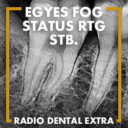 Röntgen - 2. helyiség - Fogászati és fül-orr-gégészeti röntgen, cbct készítése