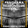 Röntgen - 1. helysiég - Fogászati és fül-orr-gégészeti röntgen, cbct készítése